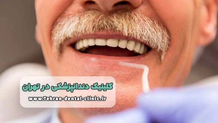 کلینیک دندانپزشکی خوب برای کامپوزیت در تهران